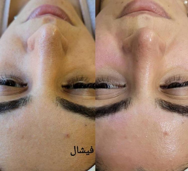دوره آموزشی متصدی فناوری پوست